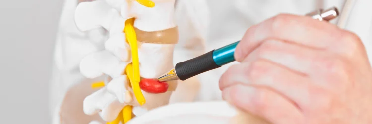 Wenatchee WA Chiropractor Discusses Herniated Discs